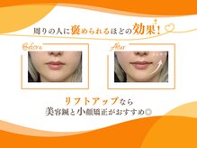 マイレ 膳所店(MAILE)の雰囲気（施術前後の効果！詳細はフォトギャラリーをCheck！[美容鍼/小顔]）