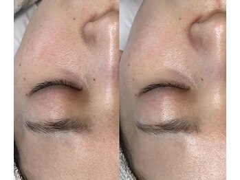 アールイー(re)/ララピール