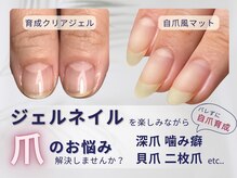 ウォームネイルルーム 古賀店(warm Nail room)の雰囲気（自爪育成×フィルイン専門店#ネイルケア#深爪#フットケア）