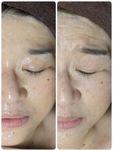 ウララ(ulala)/60代前半セルマンビフォアフ