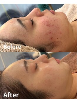 スリリアン 銀座/★お客さまビフォーアフター★