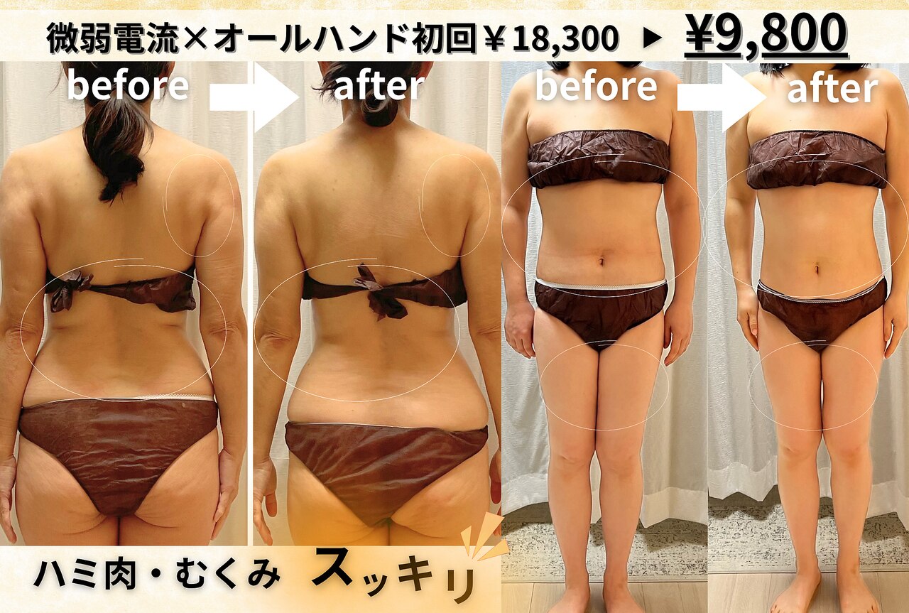 ゼロン(zelon)｜ホットペッパービューティー