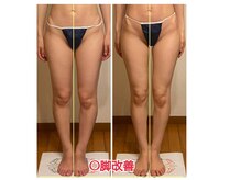 トータルボディセラピーハート(Heart)の雰囲気（【下半身太りを根本改善する特殊バンテージが大人気】Ｏ脚も改善）