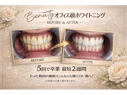 ホワイトニングプラス(Whitening+)の写真