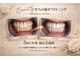 ホワイトニングプラス(Whitening+)の写真