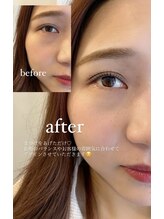 アイスタンド(eye stand)/まつ毛パーマ　before / after