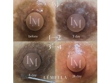 韓国直伝◎アフタークリーム1個付き*安心リタッチ1回込み料金◎