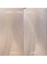 アール(ar.)/おまたエステ/フェムケア（2回）