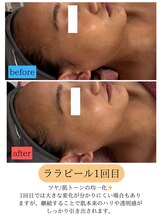 ユフラ(Juhla)/ララピール