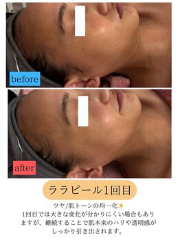 ユフラ(Juhla)/ララピール