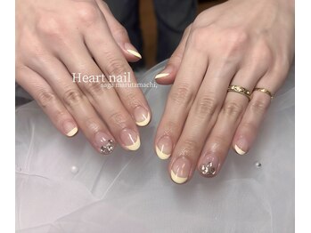 lemon yellow×french