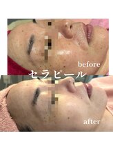 エアージーモ(Air Gmo)/透明感・水光肌へ