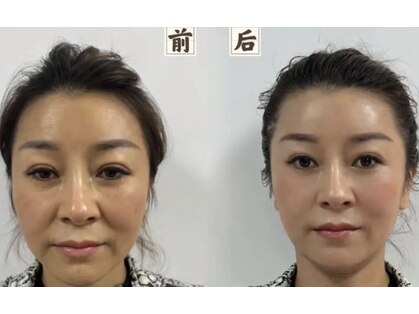 雅の写真