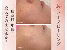 ククル(KUKULU)の雰囲気（継続することで、圧倒的にお肌は生まれ変わります！）