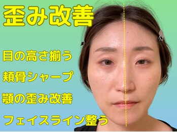 ナチュラルパーフェクトフェイス 新宿/頬骨の悩み/新宿駅小顔矯正