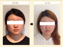 美容整体ウェリナ あま甚目寺院/小顔矯正/骨盤矯正/美脚サロン