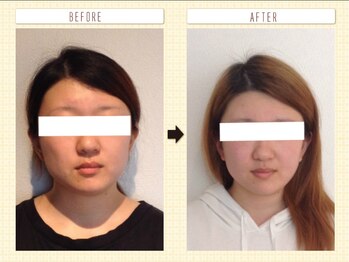 美容整体ウェリナ あま甚目寺院/小顔矯正/骨盤矯正/美脚サロン