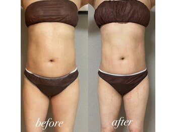 エヌボーテ(N. beaute)/お腹周り*くびれコース