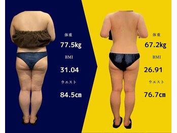 ルチノ(LUTINO)/短期間で結果を出したい方へ