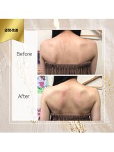 ロココ 町田店(Rococo)/姿勢改善で背中の幅が細く！