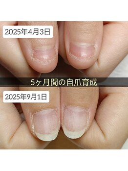 マニエネイル(mani e nail)/深爪矯正で美爪育成しませんか？