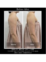 サロンドベル(salon de Belle)/痩身/ダイエット/リバウンド無し