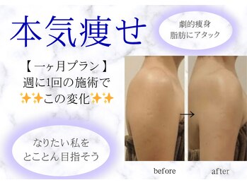 ミライ 福岡筑紫野店(mirai)