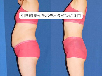 アンシャンテ 芦屋店/医師監修痩身