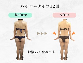 美容整体ウェリナ 中川八田院/小顔矯正/骨盤矯正/痩身整体