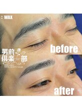 男前倶楽部/脱毛/メンズ脱毛/メンズ専門店
