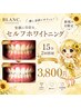 【推し活前にサクッと！男性もOK】セルフホワイトニング15分×2回￥3800