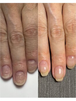 自爪育成/クリア/トラブル爪