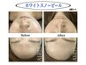 3年連続受賞記念【美白×エイジングケア】ホワイトスノーピーリング 5,500円