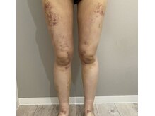 サロンシファ(salon sifa)の雰囲気（インディバ術後ケア/美容施術後のダウンタイム緩和♪）