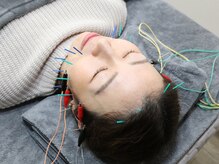 リノンの雰囲気（【ＳＮＳで話題沸騰！】たるみ改善リフト美容鍼で素肌力アップ◎）