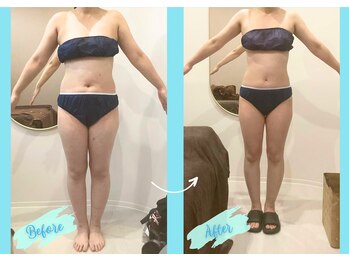 千歳の女神 西尾本店/【施術風景】Before/After