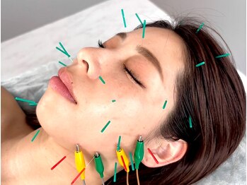 美容鍼灸サロン ユールーム(YOUROOM)の写真/【美容鍼×ララピール】芸能人モデル話題の美容鍼＆ララピールでお顔の悩み徹底改善♪《肩こり/腰痛にも》