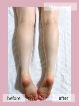 ヒトヤスミ(Hitoyasumi)/フットマッサージ