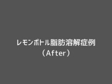 オアシスラグーン(OASIS LAGOON)/レモンボトル症例