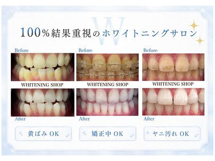 ホワイトニングショップ 旭川店の写真