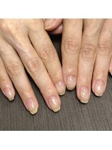 サンマルイチ(301)/自爪育成／クリア