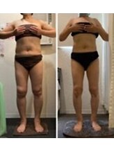 ラヴィニティ 自由が丘店(Lavinity)/【40代】ビフォー、アフター