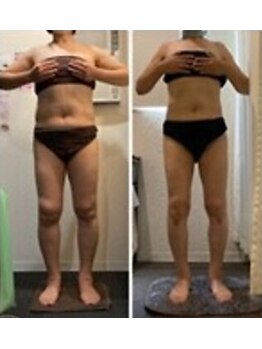 ラヴィニティ 自由が丘店(Lavinity)/【40代】ビフォー、アフター