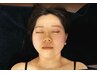 【小顔リフトアップ効果◎】確実に引き締めるメディセル＋美容鍼40分￥6000→