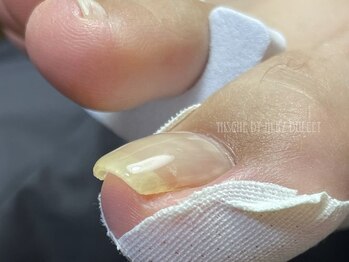 クロエ(Kcloe)の写真/爪が薄い/折れやすい/形が悪い等のお悩みを持つ方にオススメ☆丁寧なケアで指先の美しさを際立たせます♪