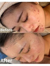 スリリアン 銀座/★お客さまビフォーアフター★