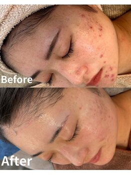 スリリアン 銀座/★お客さまビフォーアフター★