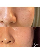 ジュエッテ(jouete)/シーナジーピール