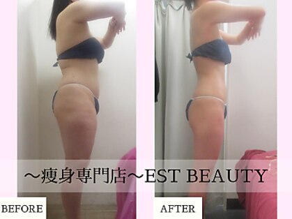 エストビューティー 池袋店(EST BEAUTY)の写真