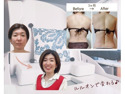 ヨサパーク リノ(YOSA PARK Lino)の写真
